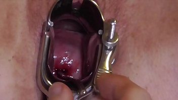 Analslut p. Cervix - James opens Analslut's cunt, and sounds her cervix deep while she is on her p.